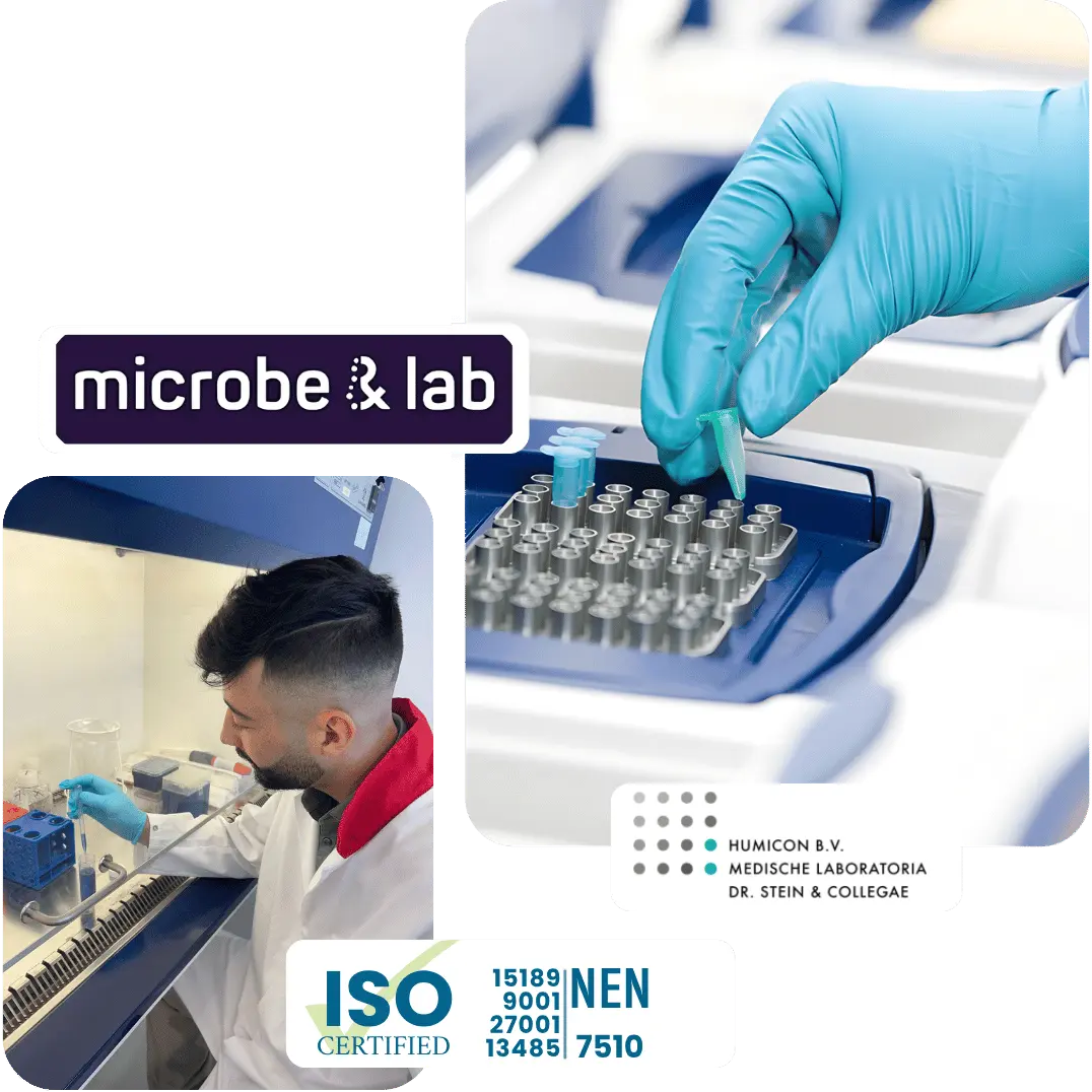 ISO 15189 en NEN 7510 gecertificeerd laboratorium van Microbe & Lab voor nauwkeurige testuitslagen.